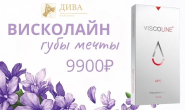 Висколайн