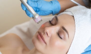 RF-лифтинг: что такое радиочастотное омоложение
